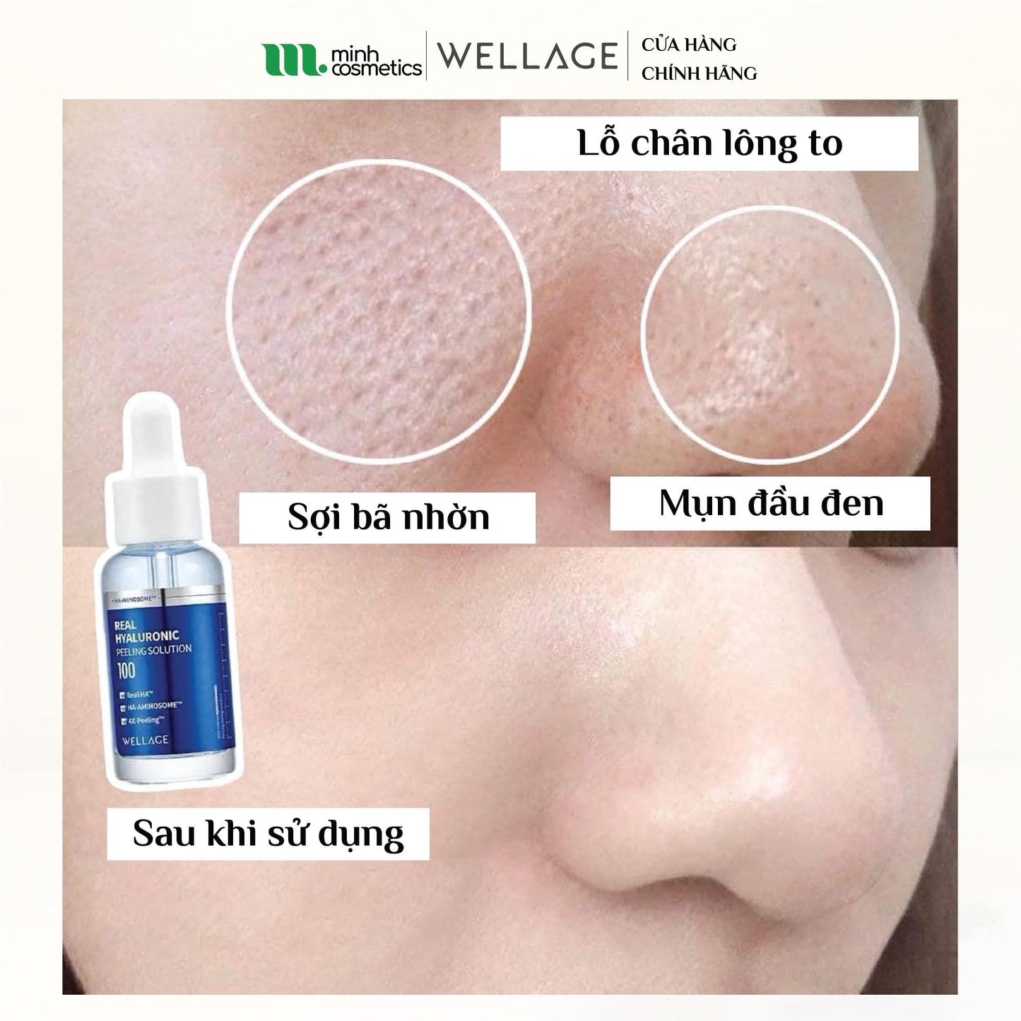 REAL HYALURONIC PEELING SOLUTION WELLAGE