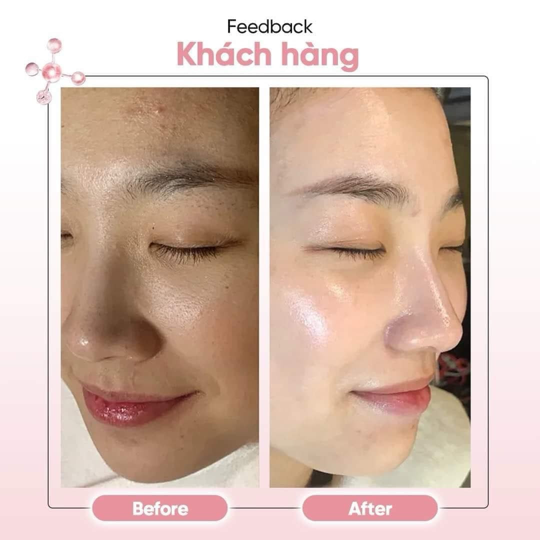 Nước uống tế bào gốc Placenta Hebora