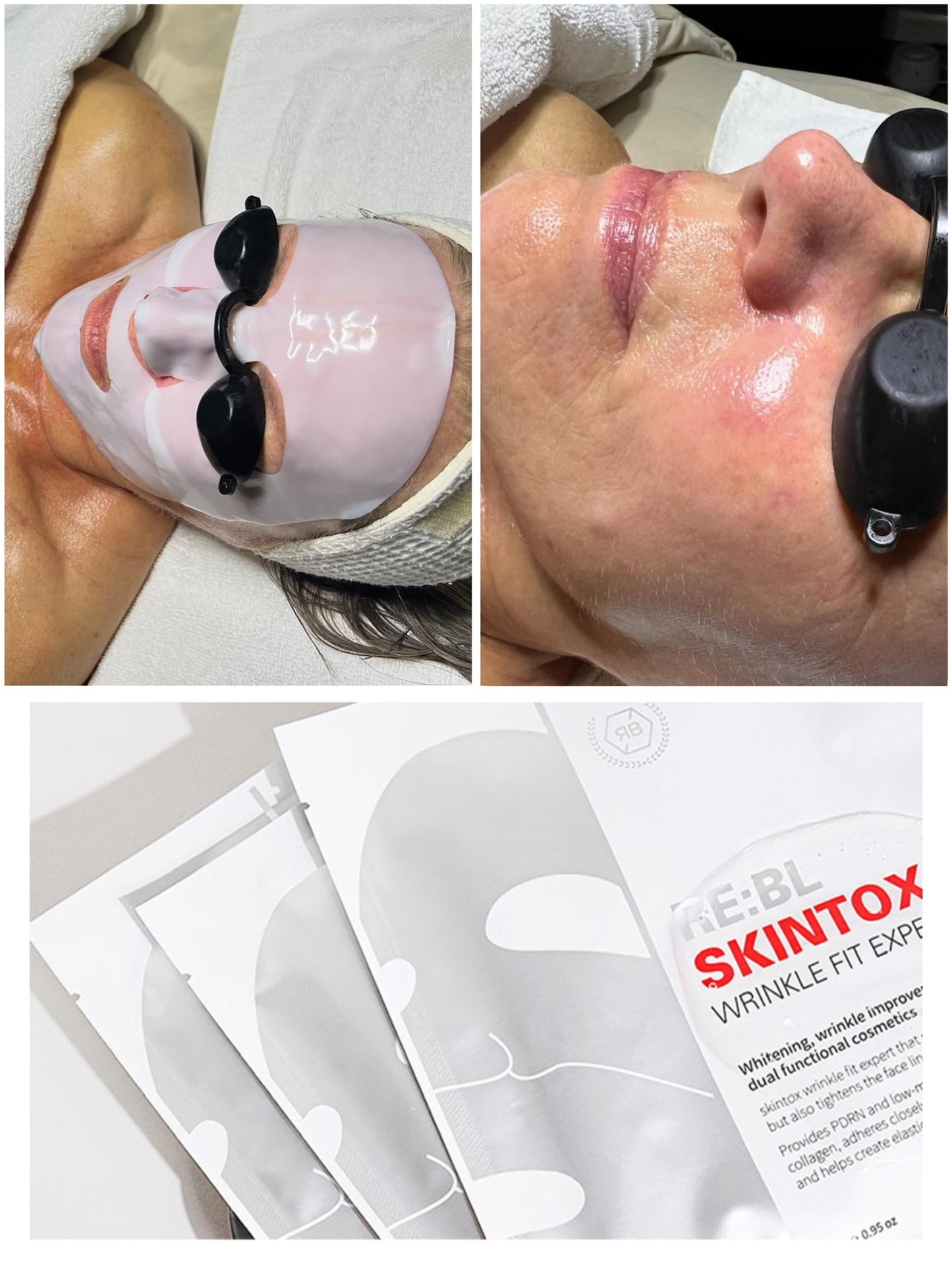 SKINTOX WRINKLES FIT EXPERT MASK - MẶT NẠ NÂNG CƠ, CHỐNG CHẢY XỆ