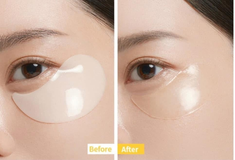 VITA COLLAGEN EYE CREAM PATCH MEDIANSWER - MẶT NẠ MẮT