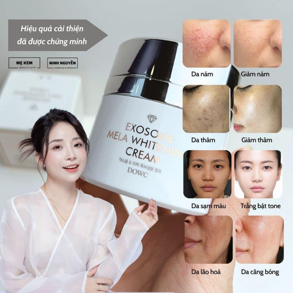 EXOSOME MELA WHITENING CREAM