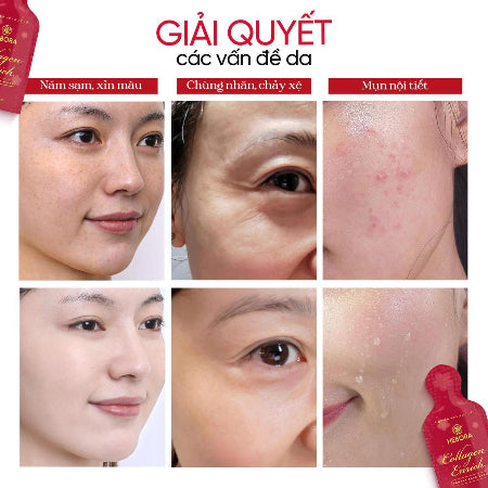 HEBORA - Nước uống Collagen Enrich Nhật Bản