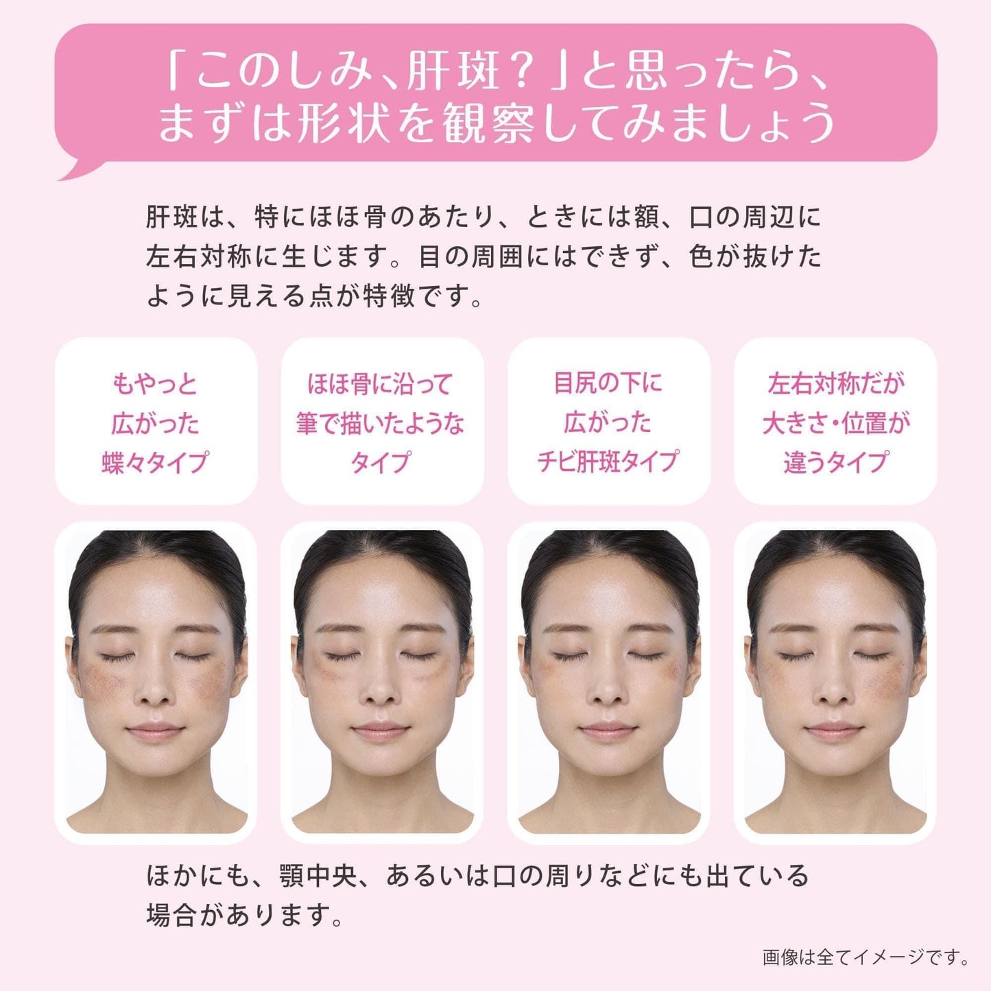 TRANSINO II - VIÊN UỐNG TRỊ NÁM SỐ 1 NHẬT BẢN 🇯🇵