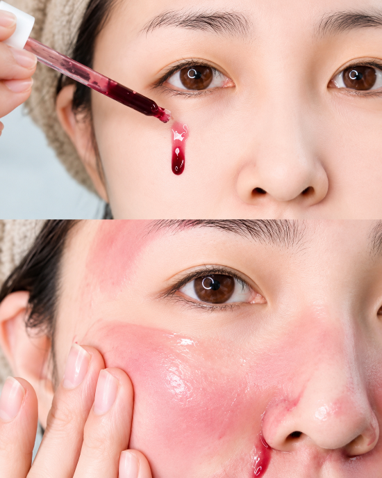 SO NATURAL Red Peel Tingle Serum - Serum tẩy tế bào chết So Natural
