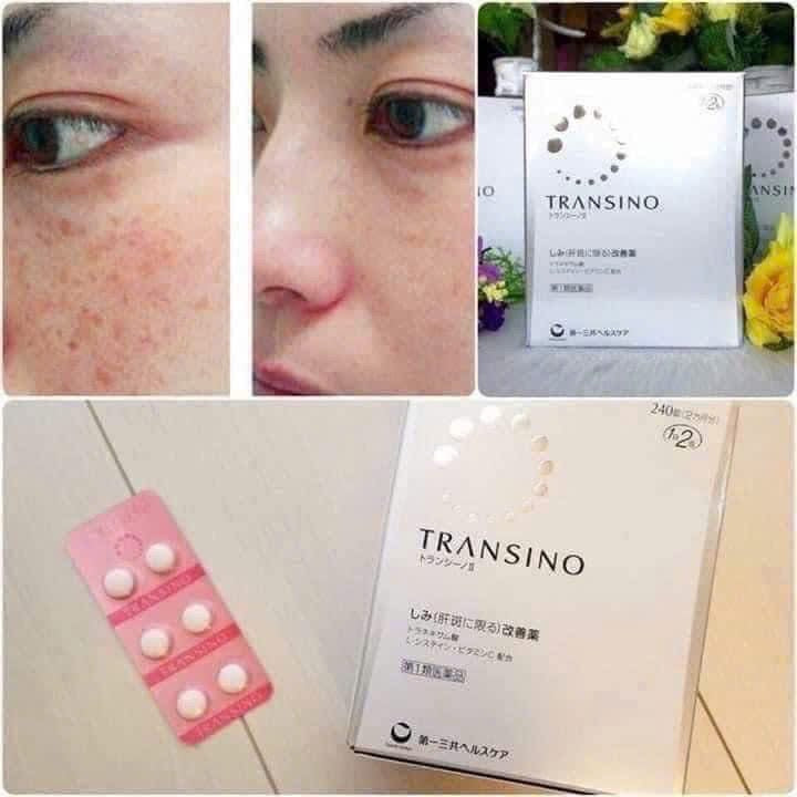 TRANSINO II - VIÊN UỐNG TRỊ NÁM SỐ 1 NHẬT BẢN 🇯🇵