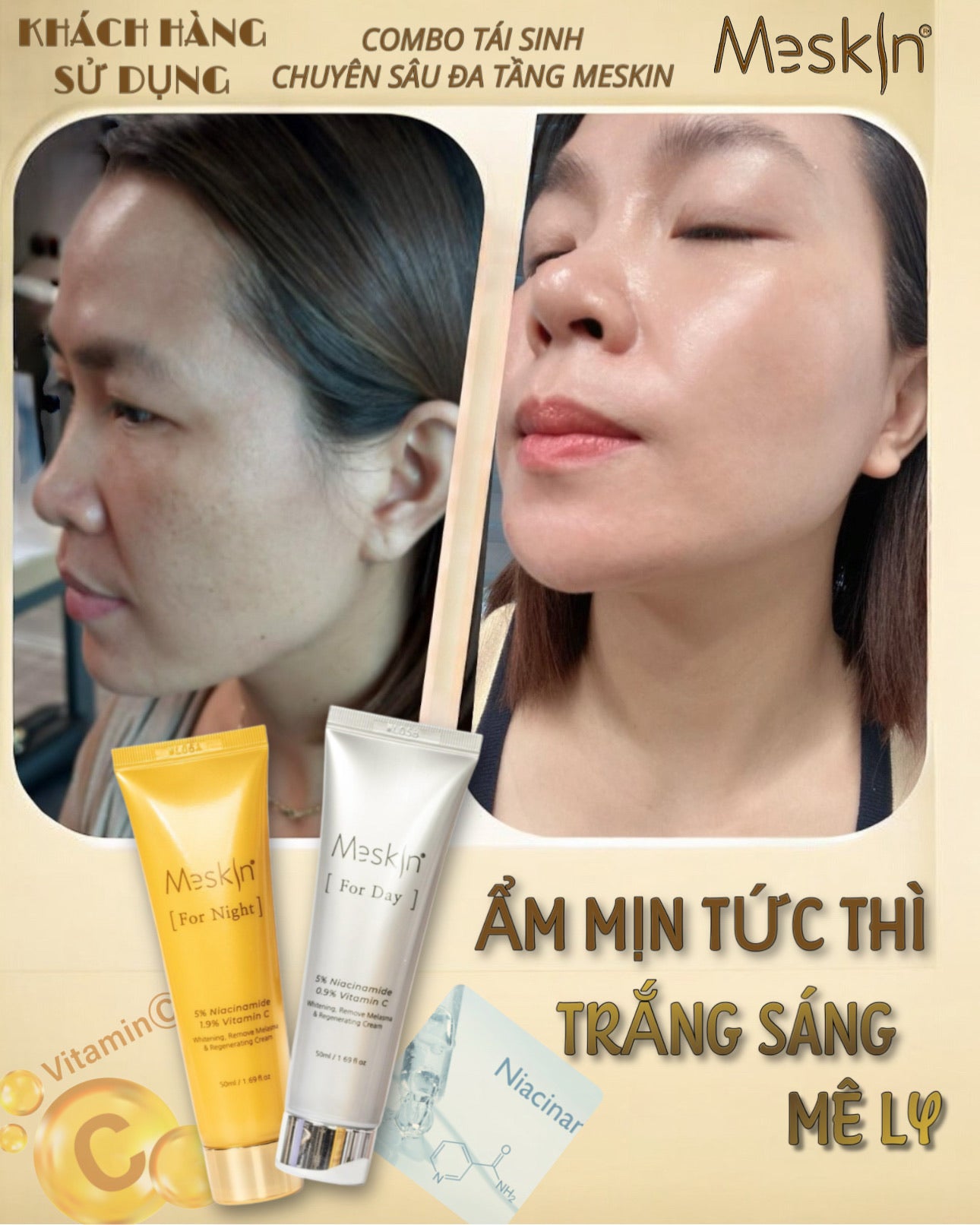 MESKIN KOREA - KEM DƯỠNG TRẮNG DA, MỜ NÁM NGÀY & ĐÊM