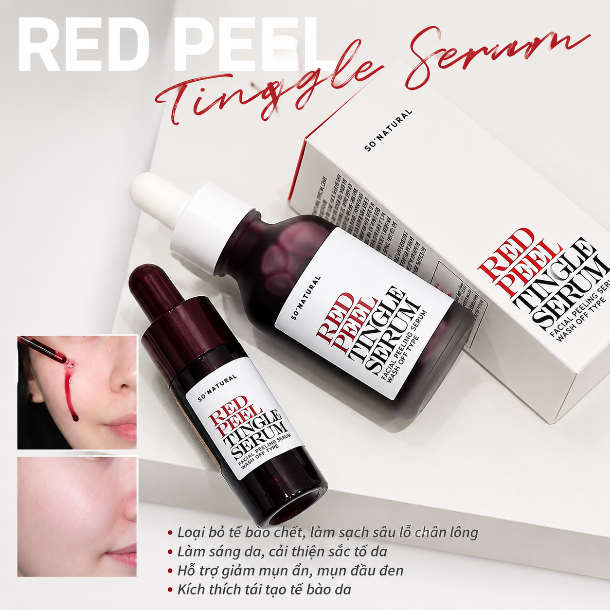 SO NATURAL Red Peel Tingle Serum - Serum tẩy tế bào chết So Natural