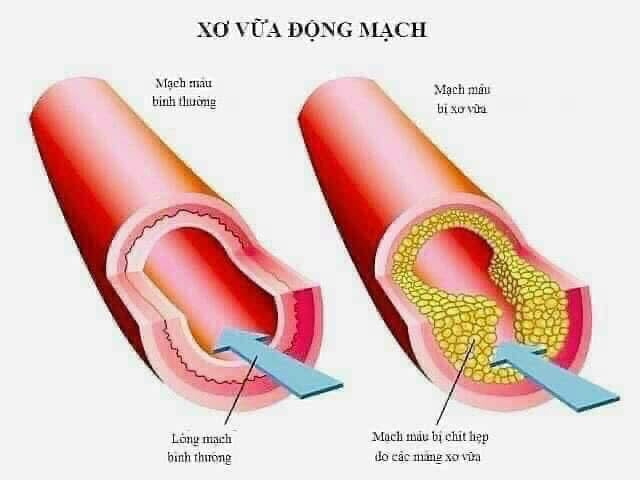 SMS BIO PHARM- TINH DẦU THÔNG ĐỎ CHÍNH PHỦ HÀN