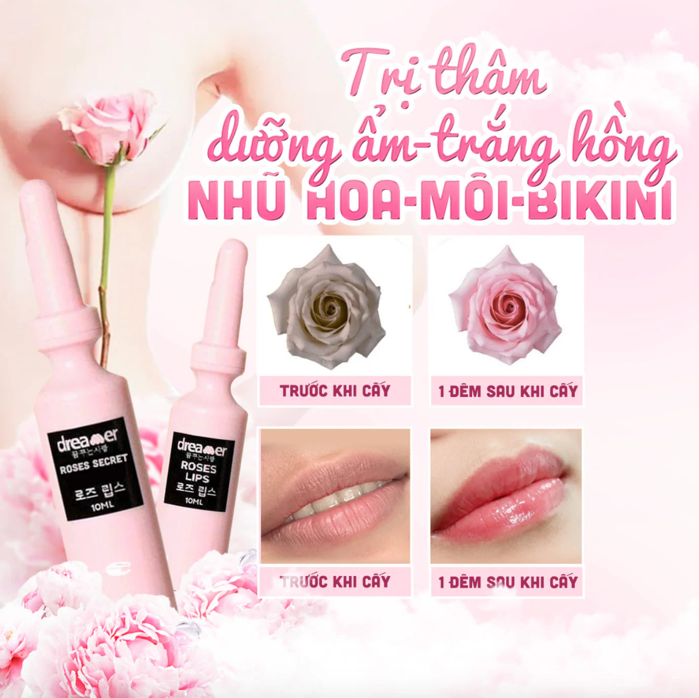 DREAMER ROSES - Tinh Chất Cấy Hồng Môi / Nhũ / Bikini